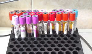 Реструктуризация ждет лабораторию Раменской больницы